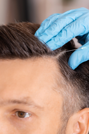 Hair Loss Solutions