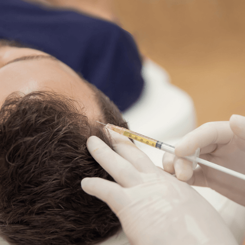 PRP HAIR RESTORATION