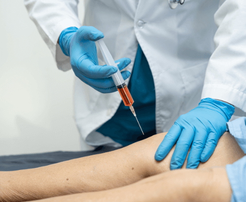 PRP JOINT INJECTIONS